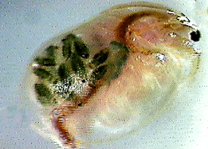 Image of female daphnia with unfertilized eggs